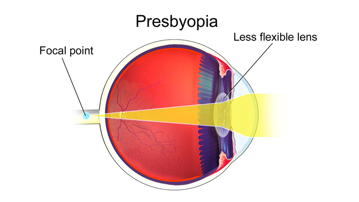 Eye Drops For Ageing Vision | Found This Week - Technology, Science ...